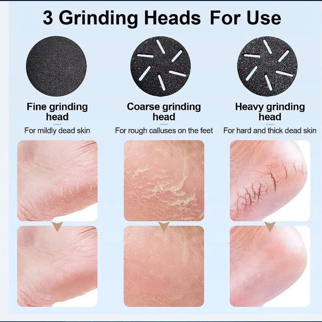 Electric Foot Callus Remover | Rechargeable Hard Skin Remover for Smooth Feet